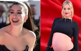 Người phụ nữ đẹp nhất thế giới 2026 chiếm mọi ánh nhìn