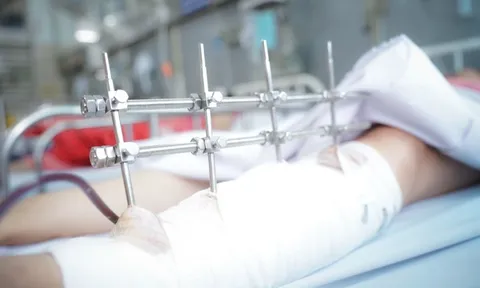 Nữ nạn nhân vụ sập tường kinh hoàng ở Long An đã thoát 'cửa tử'