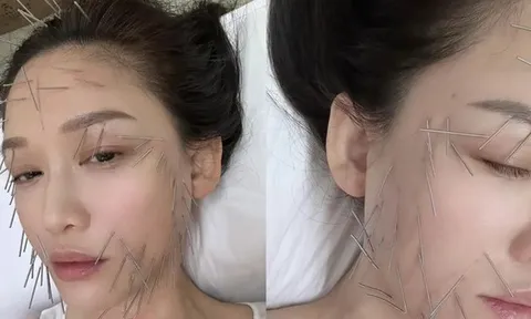 "Nữ hoàng phim thần tượng" gây sốt khi cắm hàng trăm chiếc kim khắp cơ thể