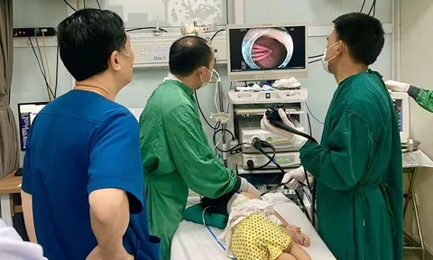 Bé gái 21 tháng tuổi suýt thủng ruột vì nuốt phải kẹp tóc