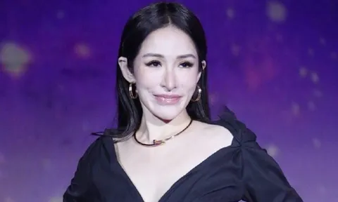 Sốc nặng trước diện mạo biến dạng của nữ diva nổi tiếng sau vụ bị chó cắn đến hủy dung