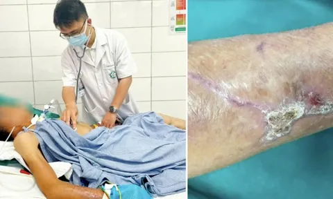 Cụ bà 90 tuổi mắc uốn ván, 5 người con tức tốc đi tiêm phòng