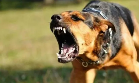 Bé trai 2 tuổi bị chó cắn lộ xương sọ