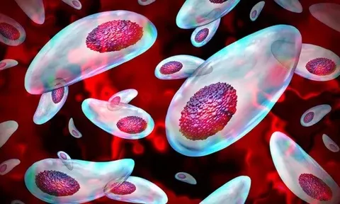 Một loại ký sinh có thể cắt đứt tinh trùng của con người, nguyên nhân gây vô sinh toàn cầu?