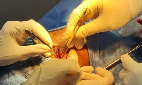 Cứu người đàn ông bị hàng xóm dùng đũa đâm xuyên hốc mắt