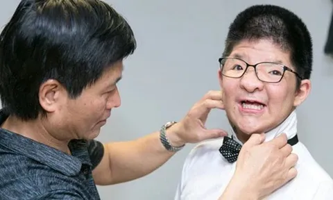 Con trai nam diễn viên Việt mắc hội chứng hiếm gặp: Các ngón bị dính vào nhau, phải bán nhà để trả viện phí