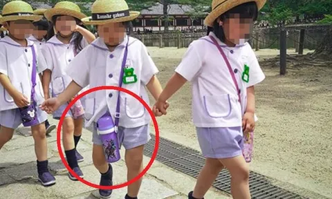 Đeo bình nước bên người, bé trai phải cắt bỏ tụy và lá lách