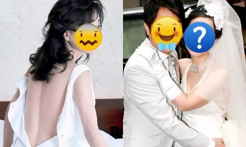 Sao nữ bị dụ dỗ "hủy dung" xấu đến ma chê quỷ hờn, bị trầm cảm nặng vì bạn trai biến mất trước ngày cưới