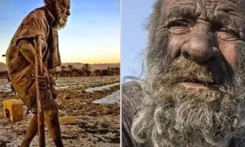 Vì sao "người đàn ông bẩn nhất thế giới" lại qua đời ngay sau khi tắm lần đầu tiên?