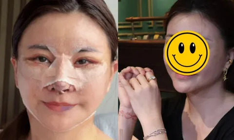 Nữ diễn viên Việt vừa phẫu thuật thẩm mỹ mặt ở Hàn Quốc bị chê mạnh, phải vội lên tiếng làm rõ 1 thông tin