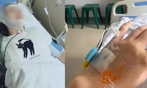 Dầm mưa 10 phút, người phụ nữ bị viêm màng não