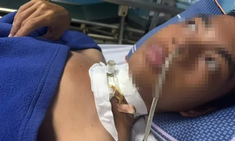 Cứu sống nam thanh niên bị đứt khí quản do vướng phải dây điện