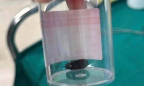 Bé trai Campuchia ho, khó thở 20 ngày không hết: Sang Việt Nam lập tức tìm ra nguyên nhân