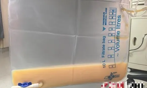 Máu trắng đục như sữa vì chủ quan với 1 việc: Bác sĩ tức giận, nói "chẳng khác nào tự bơm mỡ vào máu”