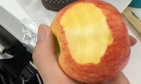 Cắn 1 quả táo nguyên mỗi ngày, 3 tháng bé gái khỏi hẳn bệnh