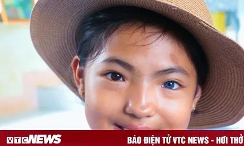 Kỳ lạ bé gái ở Đắk Lắk có hai màu mắt, một bên mắt đen và một bên mắt xanh