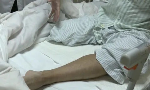 Người đàn ông bất ngờ phải cắt cụt bắp chân: Bác sĩ nói do chủ quan với 1 dấu hiệu bất thường