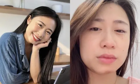 Đang chơi cùng con, TikToker "Ngọc Khánh Đây" bị thẻ đọc chữ đâm vào mắt, rách gần hết giác mạc