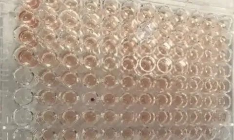 Phát hiện người mang máu kim cương