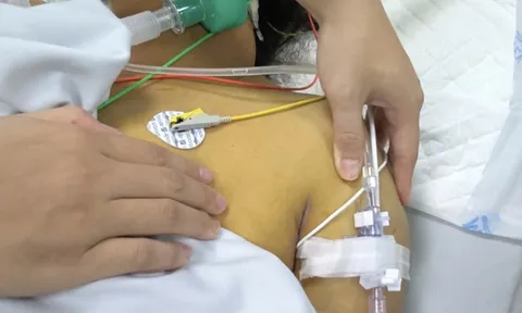 Toàn thân vàng như nghệ, suy đa tạng chỉ trong 24 giờ: Bác sĩ Hồi sức tích cực cảnh báo ‘tử thần’ mùa mưa