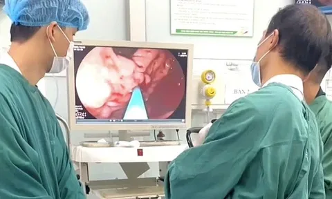 Chủ quan với cơn đau bụng, người đàn ông suýt đánh đổi bằng mạng sống