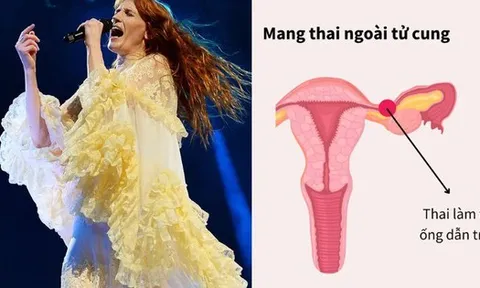 Nữ ca sĩ bị vỡ ống dẫn trứng do mang thai ngoài tử cung: "Vẫn uống thuốc giảm đau và bước ra sân khấu mà không biết nguy hiểm đang chờ"
