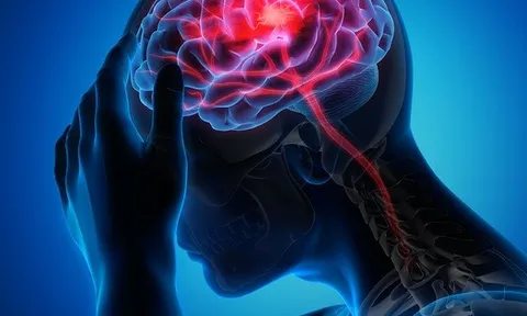Hơn 99% các cơn đột quỵ và nhồi máu cơ tim liên quan 4 điều này