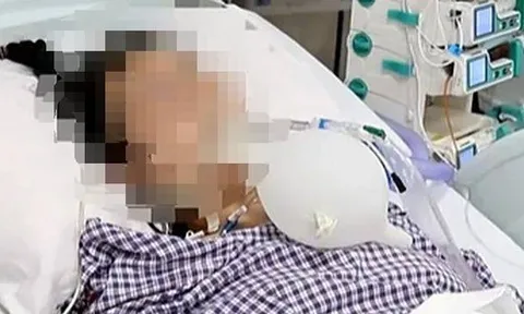 Người phụ nữ nguy kịch, suy hô hấp sau khi làm 1 việc để xóa nếp nhăn