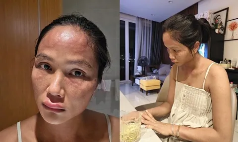 Chuyện gì xảy ra với H'Hen Niê sau khi xuất hiện với gương mặt khác lạ