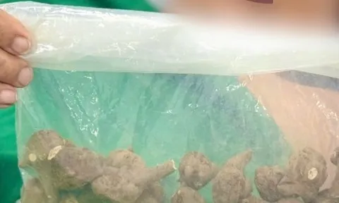 Sắc 5 củ ấu tẩu uống chữa đau khớp, cụ bà sốc tim suýt tử vong