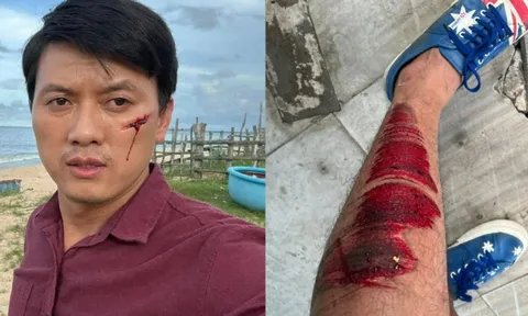 Quách Ngọc Tuyên bị tai nạn