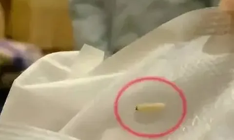 Một thương hiệu băng vệ sinh bị bóc mẽ sản phẩm có chứa “sâu sống bò lúc nhúc”