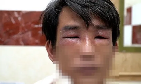 TP HCM vào mùa kiến ba khoang: cảnh báo người dân kiểm tra chăn màn