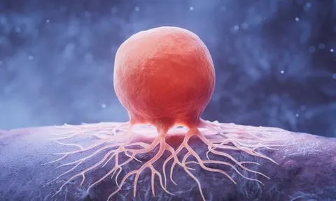 Tìm ra loại thuốc đầu tiên chống được "RNA bất tử" của ung thư