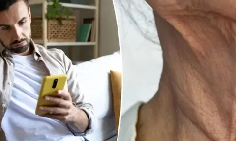 Những người trẻ da nhăn nheo, cổ chảy xệ do suốt ngày cắm mặt vào điện thoại