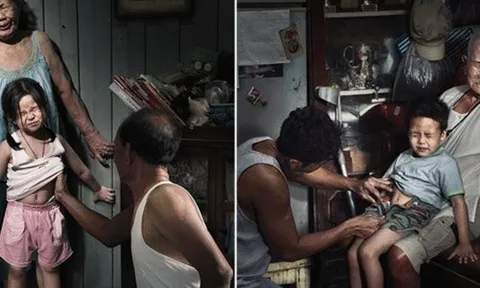 Bộ ảnh gây chấn động: "Nỗi đau theo suốt một đời"