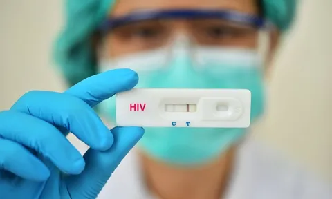 Một tỉnh thành tại Việt Nam ghi nhận 11.148 ca HIV, 6.677 ca AIDS, 99% phường xã đã có ca bệnh