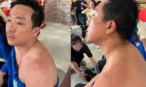 Chưa bao giờ thấy Trấn Thành tơi tả đến mức độ này