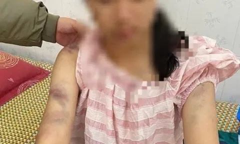 Mẹ bé gái bị bạo hành ở Thái Nguyên: Con bị đánh suốt 4 tiếng, dọa rút móng tay