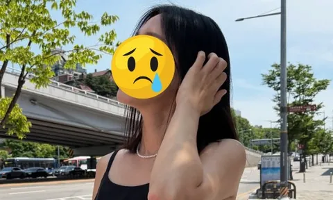 Mỹ nhân phim giờ vàng liều lĩnh "dao kéo" thu ngắn nhân trung, giờ gánh di chứng đến suốt đời