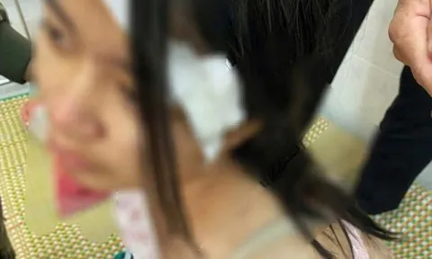 Kết quả giám định thương tật bé gái bị bà nội và 2 người đàn ông hành hạ