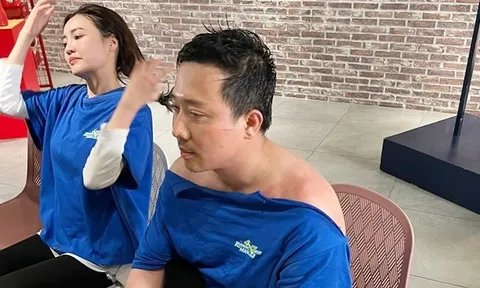 Lộ ảnh Trấn Thành bị bầm dập, tả tơi khiến fan xót xa