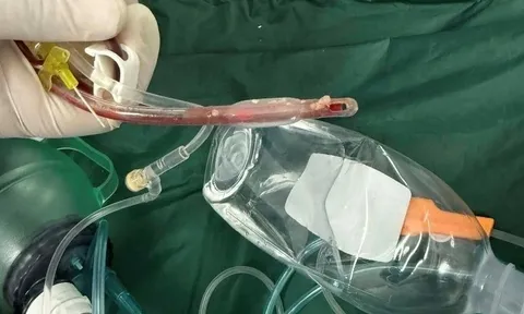 Bé gái 3 tuổi tử vong sau khi sặc thức ăn tại lớp mẫu giáo ở TPHCM