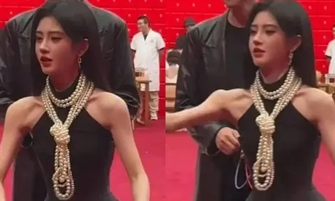 Cam thường lộ vai dị dạng của mỹ nhân 4000 năm có một