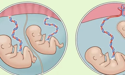 Bé trai nặng chưa đầy 1 kg được cứu sống thần kỳ