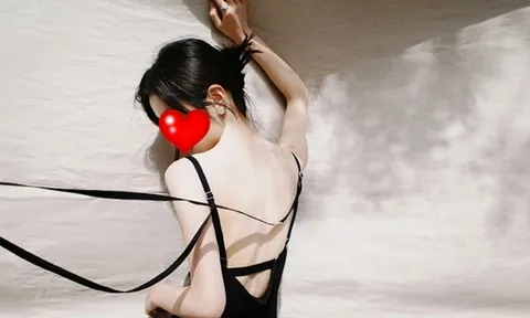 Sao nữ gen Z lộ vết bầm bất thường trên ngực và cánh tay