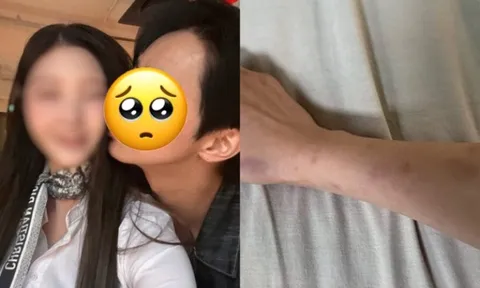 Công bố kết quả điều tra vụ nam diễn viên ngoan hiền bị tố đánh đập, “đào mỏ” bạn gái hàng trăm triệu