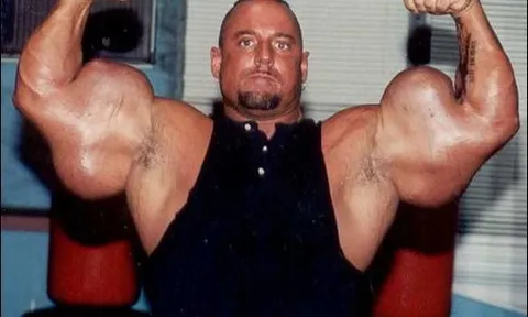 VĐV thể hình sở hữu “cánh tay quái dị” nhất thế giới, sự thật phía sau khiến tất cả ngỡ ngàng