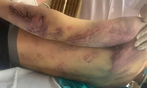 Tạm giữ 8 người liên quan đến vụ học viên 17 tuổi tử vong tại trung tâm công tác xã hội