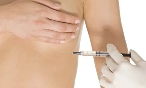 Tiêm filler nâng ngực đón Tết, người phụ nữ nhập viện vì áp xe nặng